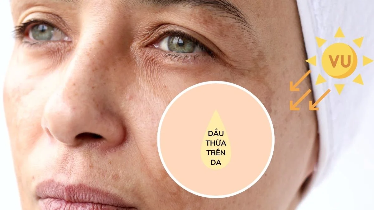 Nhược điểm quan trọng nhất là dầu oliu dễ gây bắt nắng