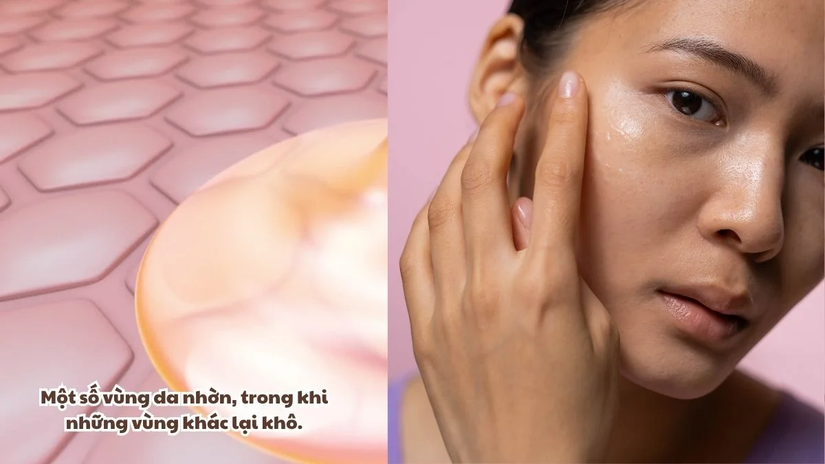Da mất cân bằng độ ẩm trên da