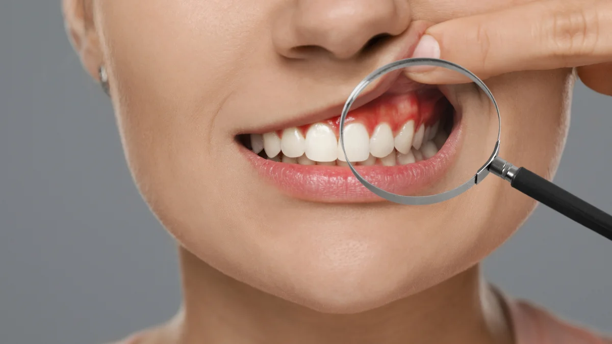 Ngậm dầu mè giúp hỗ trợ giảm viêm nứu