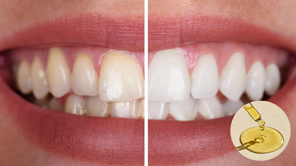 Giúp răng chắc khẻo trắng sáng