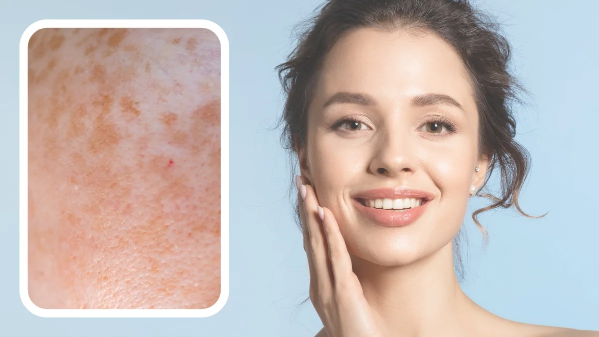 Giúp thúc đẩy tế bào mới phát triển tái tạo lại da