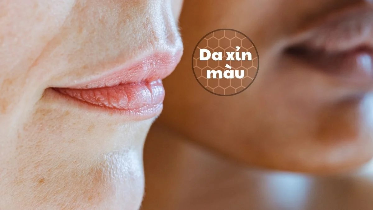 Da bi tăng sắc tố, nhiễm màu