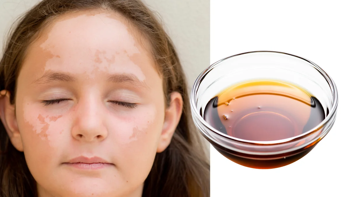 Dầu mè có thể làm dịu da hiệu quả