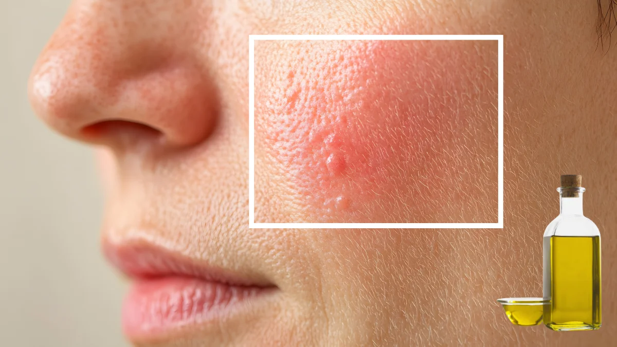 Dầu mè chứa các đặc tính kháng viêm