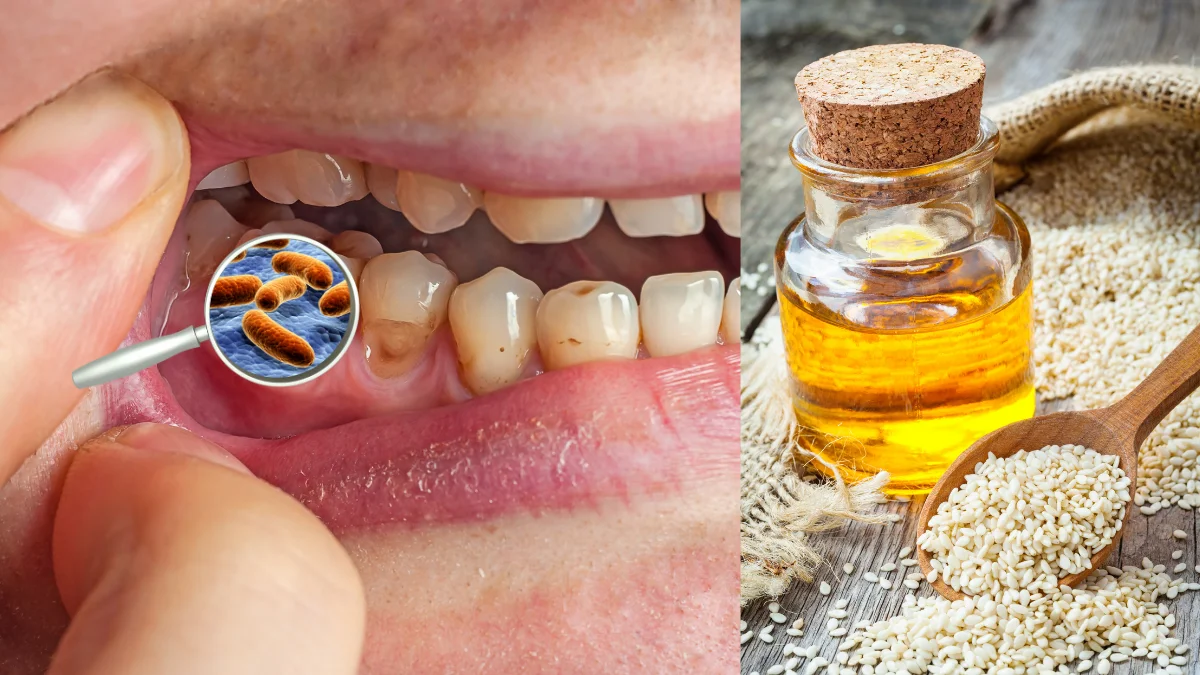 Ngậm dầu mè giúp loại bỏ vi khuẩn trong khoan miệng