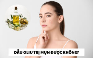 Hướng dẫn cách sử dụng dầu oliu trị mụn hiệu quả